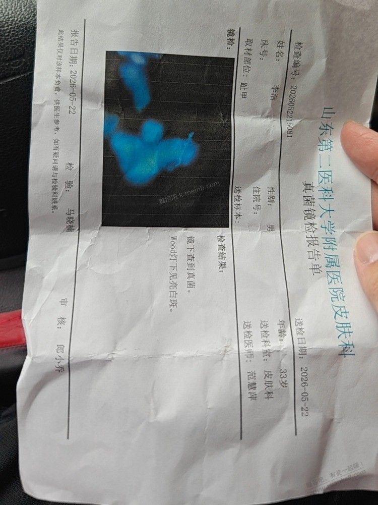吧里有甲癣 治好的吗?哎喝了7个疗程 伊曲康挫了还没好 愁死了 - 美泡泡 吧里有甲癣 治好的吗?哎喝了7个疗程 伊曲康挫了还没好 愁死了 - 美泡泡